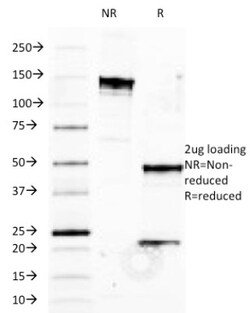 HLA B Antibody (JOAN-1), Novus Biologicals 0.2mg; Unlabeled:Antibodies,